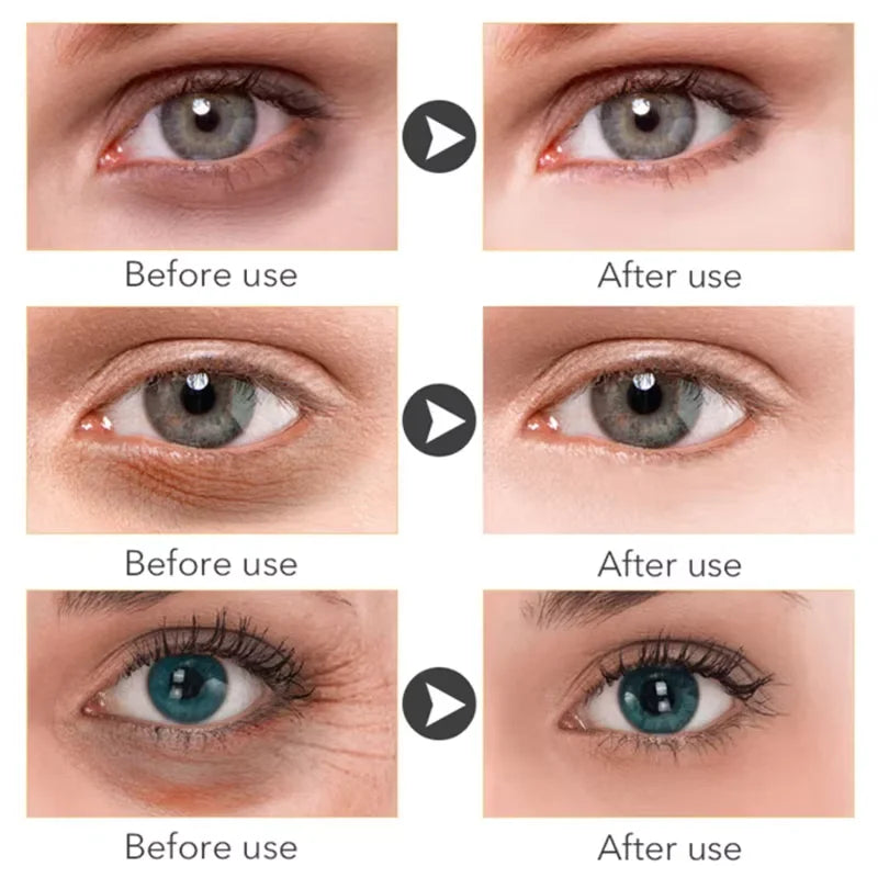 Anti Dark Circle Eye Serum Oil Retinol Anti Wrinkle.